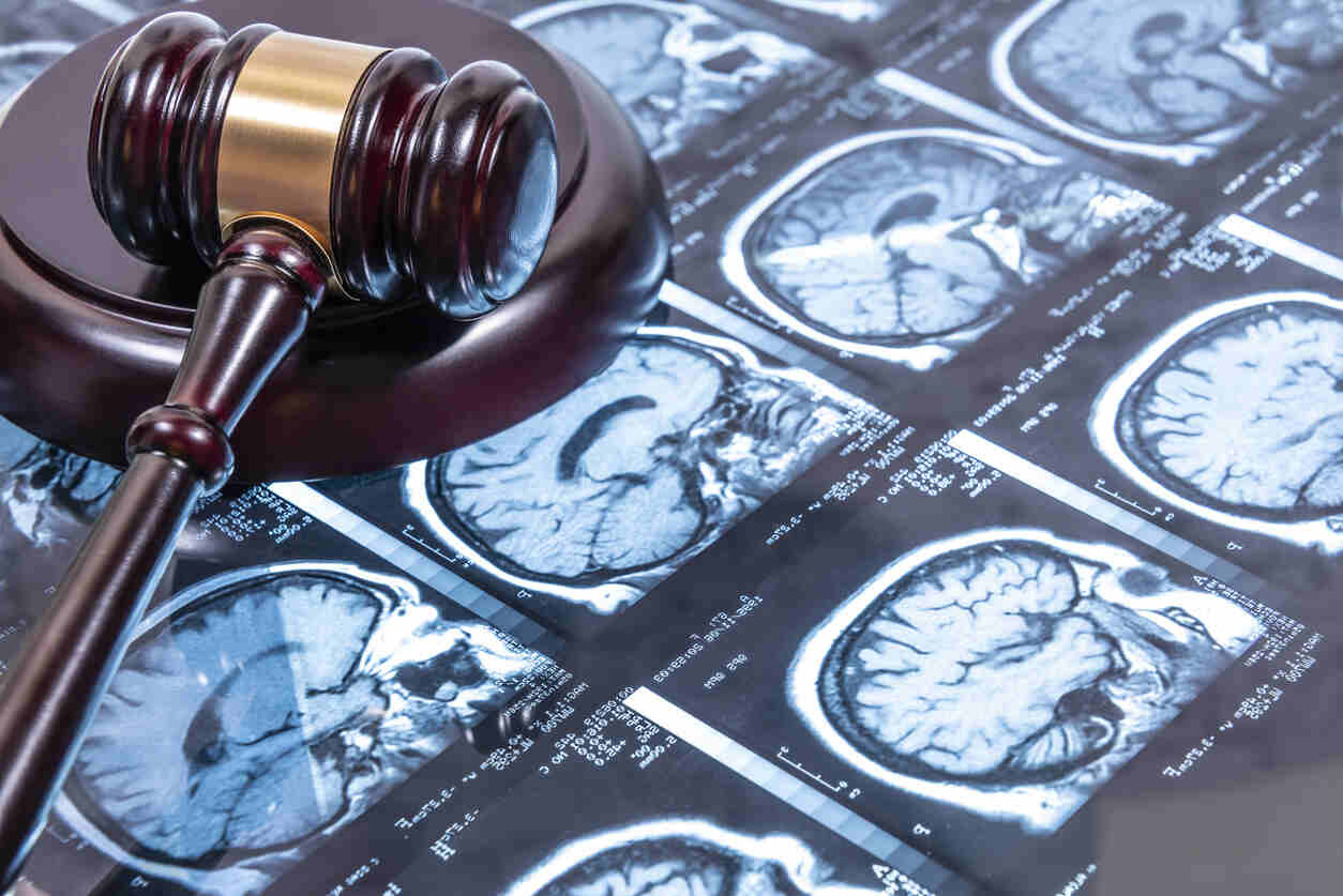 Traumatic Brain Injury Lawyer